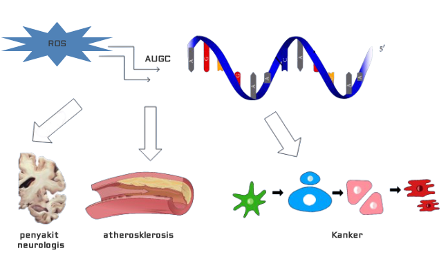 Gambar 1. Peran kerusakan oksidatif RNA terhadap berbagai penyakit degeneratif kronis (gambar diedit dari Fimognari, 2015)
