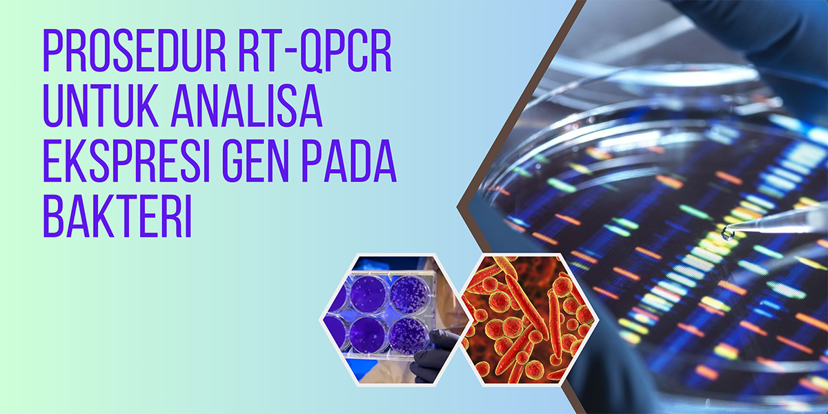 Prosedur RT-qPCR Untuk Analisis Ekspresi Gen Pada Bakteri - PT Indogen ...