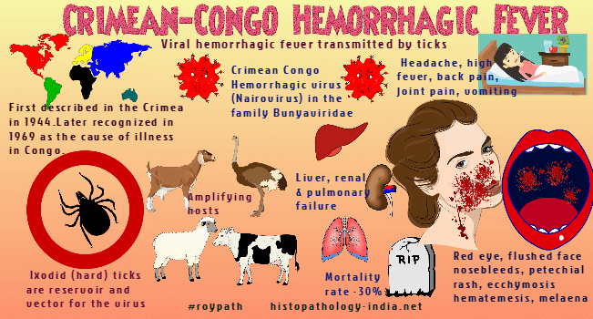 Gambar 1. Infeksi Patogen Crimean-Congo Hemorrhagic Fever Virus (CCHFV)