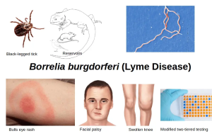 Gambar 2. Infeksi Patogen Borrelia burgdorferi (BB)