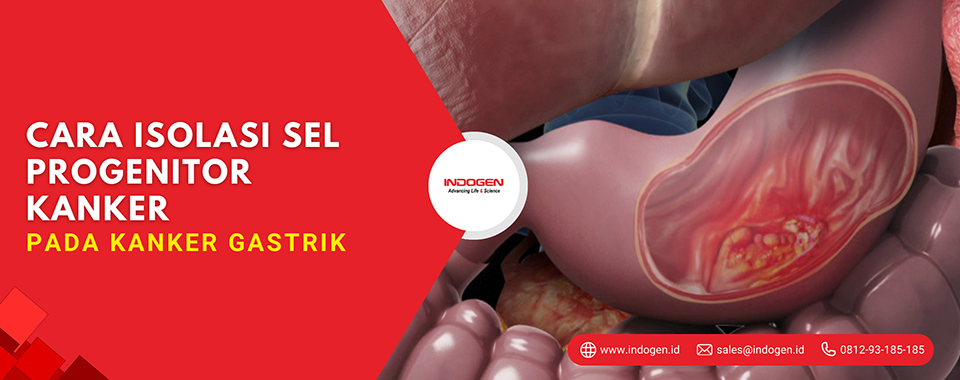 Cara Isolasi Sel Progenitor Kanker Pada Kanker Gastrik
