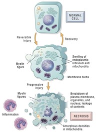 Gambar 2. Ilustrasi Jalur Kematian sel Nekrosis.Sumber: https://www.andreasastier.com/blog/the-different-types-of-necrosis-and-their-histological-identifications