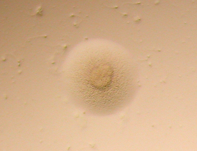 Gambar 3. Koloni M. hominis di agar PPLO (magnification 125x)
