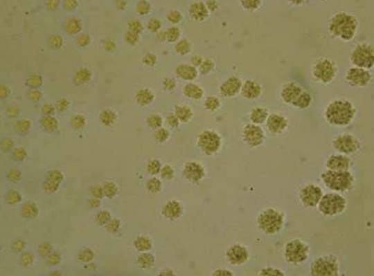 Gambar 4. Koloni Ureaplasma di agar PPLO (magnification 10x)