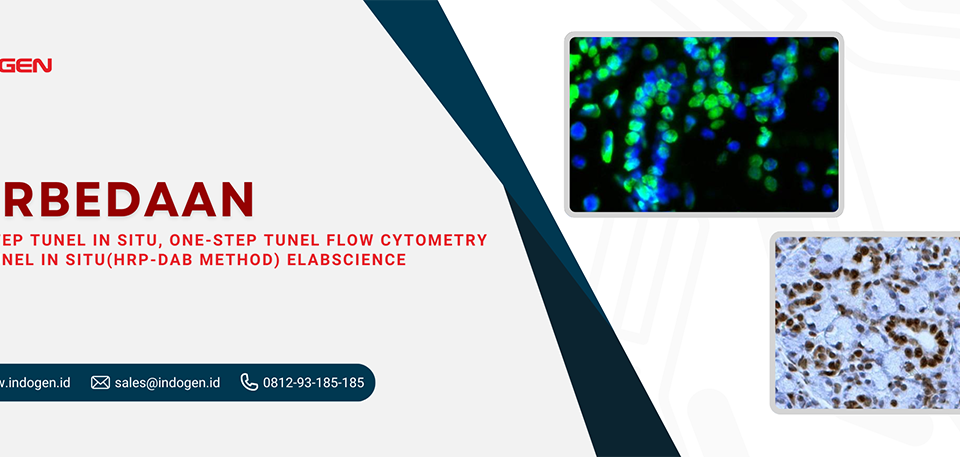Perbedaan One-step TUNEL In Situ, One-step TUNEL Flow Cytometry dan TUNEL In Situ(HRP-DAB Method) Elabscience