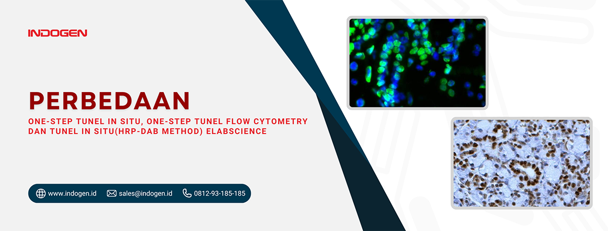 Perbedaan One-step TUNEL In Situ, One-step TUNEL Flow Cytometry dan TUNEL In Situ(HRP-DAB Method) Elabscience