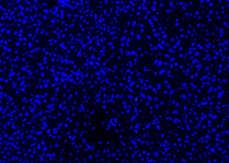 gambar negatif dapi 1