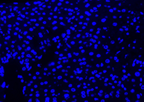 gambar negatif dapi 4x