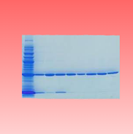 Nucleic Acid Electrophoresis