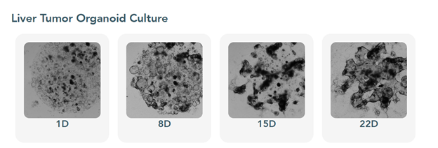Gambar 1a. Kultur Organoid Tumor Hati