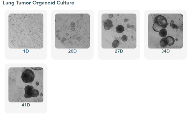 Gambar 1b. Kultur Organoid Tumor Paru