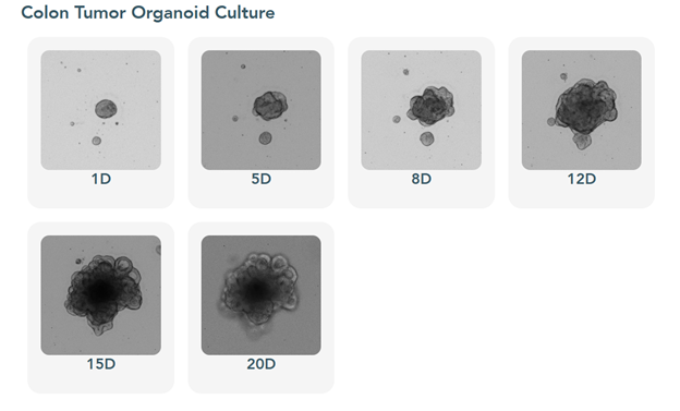Gambar 1c. Kultur Organoid Tumor Kolon