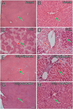 Gambar 1. Analisis histologi terhadap cedera hati akut yang disebabkan oleh induksi CCl₄ (Kabir dkk., 2014)
