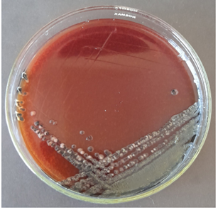 Gambar 1. Contoh koloni bakteri pada Koloni bakteri pada Salmonella Shigella Agar (Zain dkk., 2021)