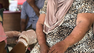 Gambar 1. Kusta Tergolong Penyakit Tropis Terabaikan yang Bisa Picu Disabilitas Fisik.Sc: Liputan6.com/Ade Nasihudin