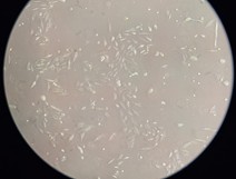Gambar 11. Penampakan Cells A549 yang ditumbuhkan dengan medium DMEM belum konfluens pada pengamatan hari ke-3
