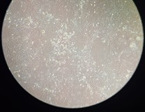 Gambar 12. Penampakan Cells A549 yang ditumbuhkan dengan medium DMEM sudah konfluens dan menumpuk (overgrown) pada pengamatan hari ke-3