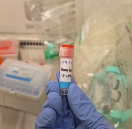 Gambar 14. Cryovial Human Lung Cancer A549