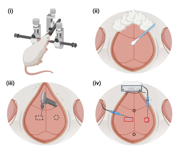 Gambar 1. Ilustrasi Skematik Penempatan alat Stereotaksis.