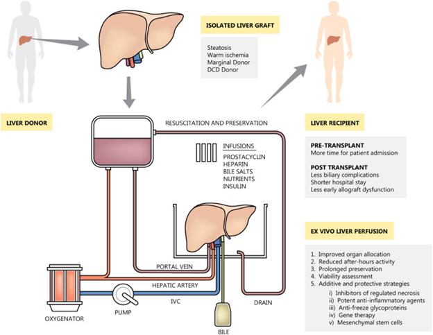 Gambar 1. Sistem Ex Vivo Liver Perfusion