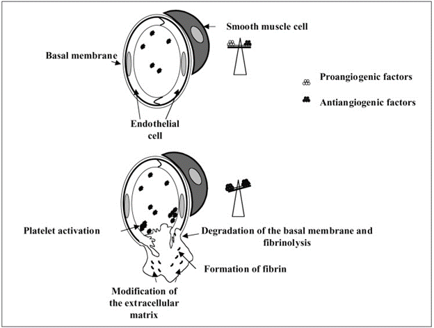 Gambar 2. Deskripsi proses remodeling yang diinduksi oleh angiogenesis (digambar ulang dari Suh, 2000) dalam Kubis dan Levy, 2004.