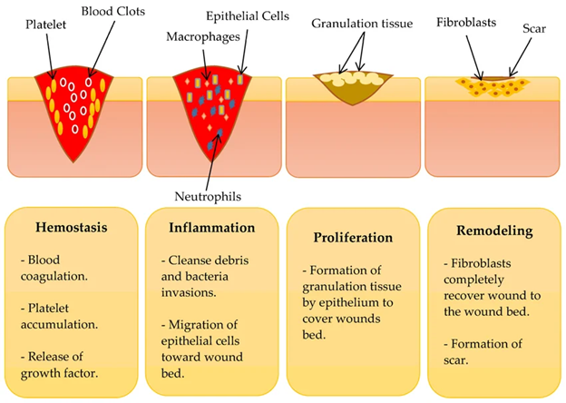 Gambar 3. Tahapan Penyembuhan Luka (Wound Healing)(Yasin dkk., 2023)