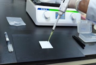Gambar 31. Penambahan ECL pada membrane dan marker