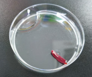 Gambar 7. Jaringan limpa (spleen) yang diisolasi