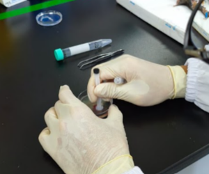 Gambar 9. Proses disosiasi jaringan secara mekanik (grinding)