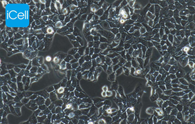 Human Colon Cancer Cells ht29