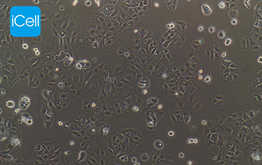 Human Colon Cancer Cells