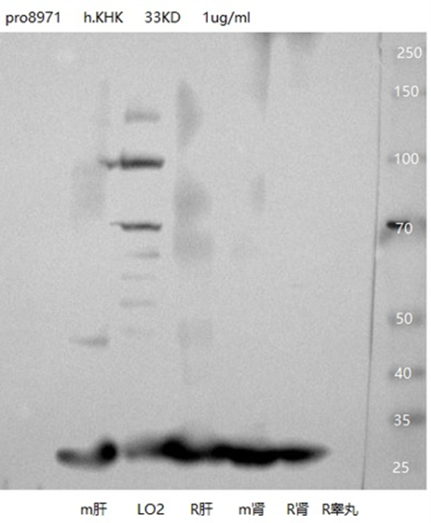 KHK antibody