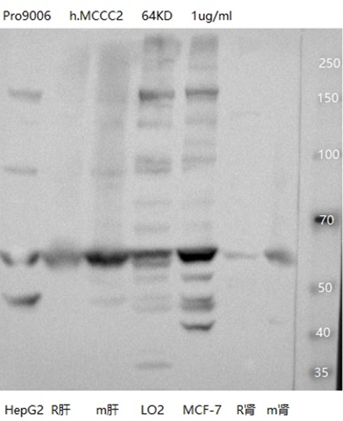 MCCC2 antibody