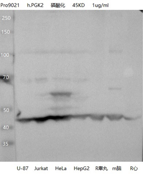 PGK2 antibody