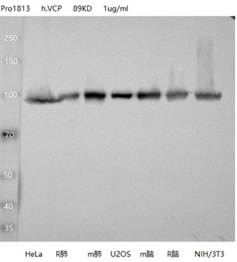 VCP antibody