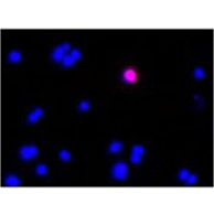 Bacstain--Series-edit