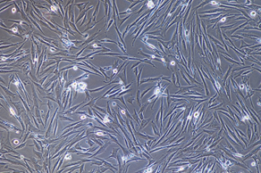 Gambar 2. Human Primary Placental Mesenchymal Stem Cells